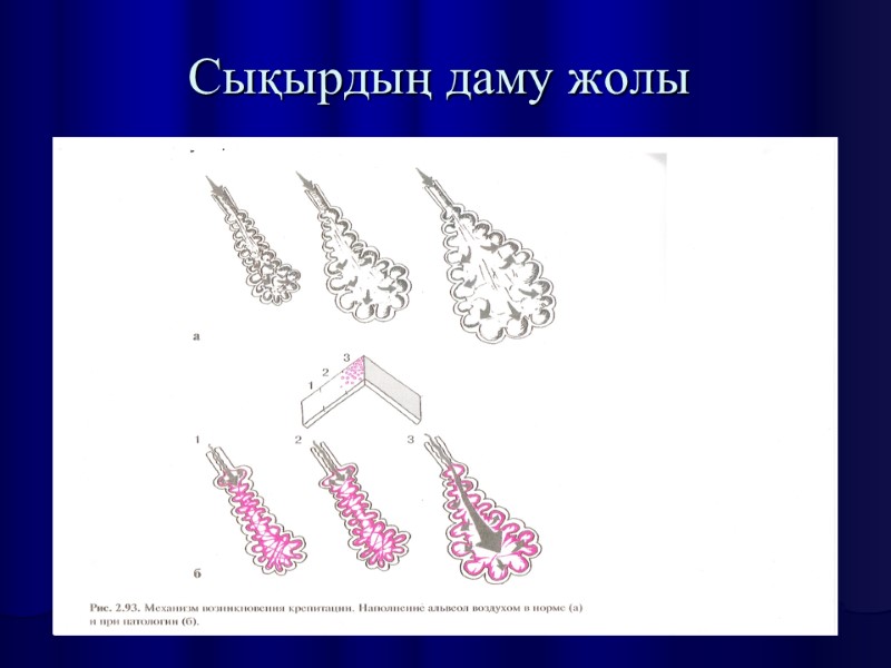 Сықырдың даму жолы